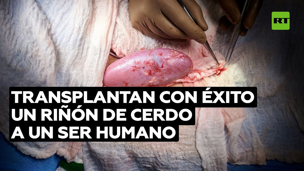 El primer trasplante exitoso de un riñón de cerdo a un ser humano @RT Play en Español