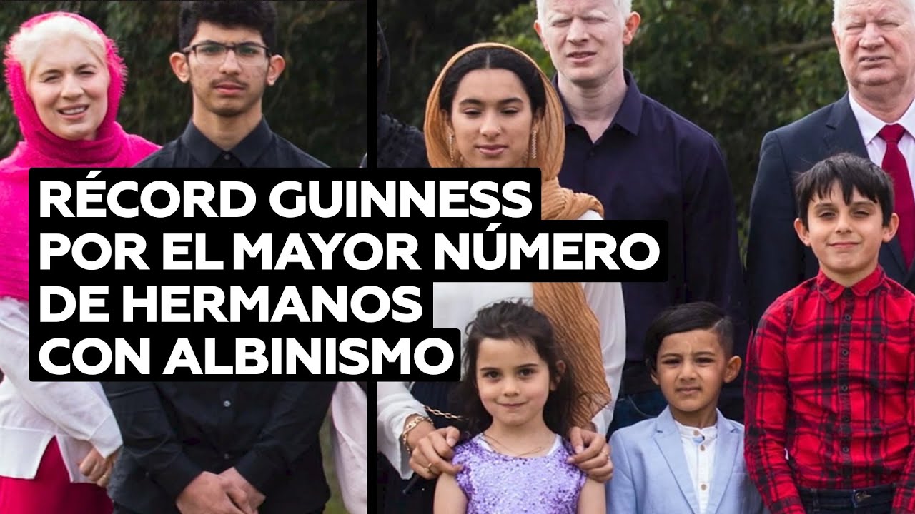 Una familia británica logró el récord mundial Guinness por el mayor número de hermanos con albinismo