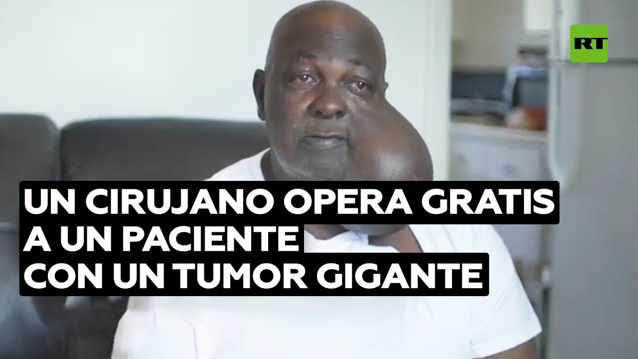 Un médico ofreció operar gratis a un hombre con un tumor gigante @RT Play en Español