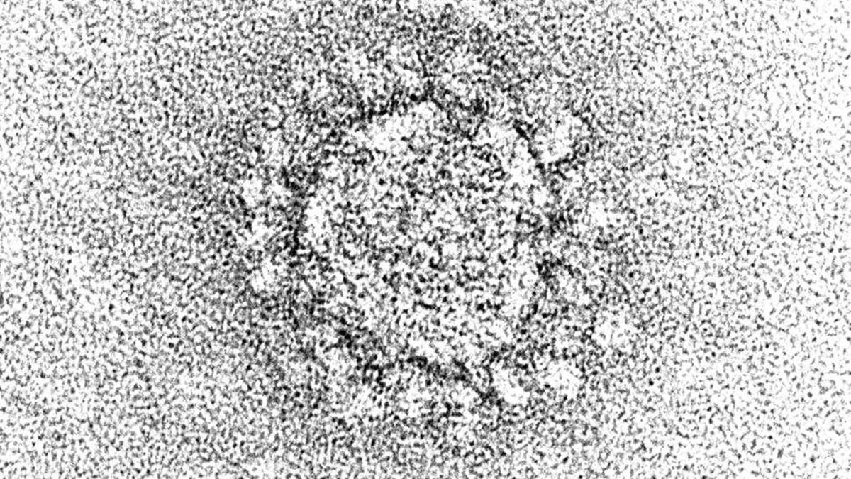 El coronavirus puede infectar y esconderse en células grasas