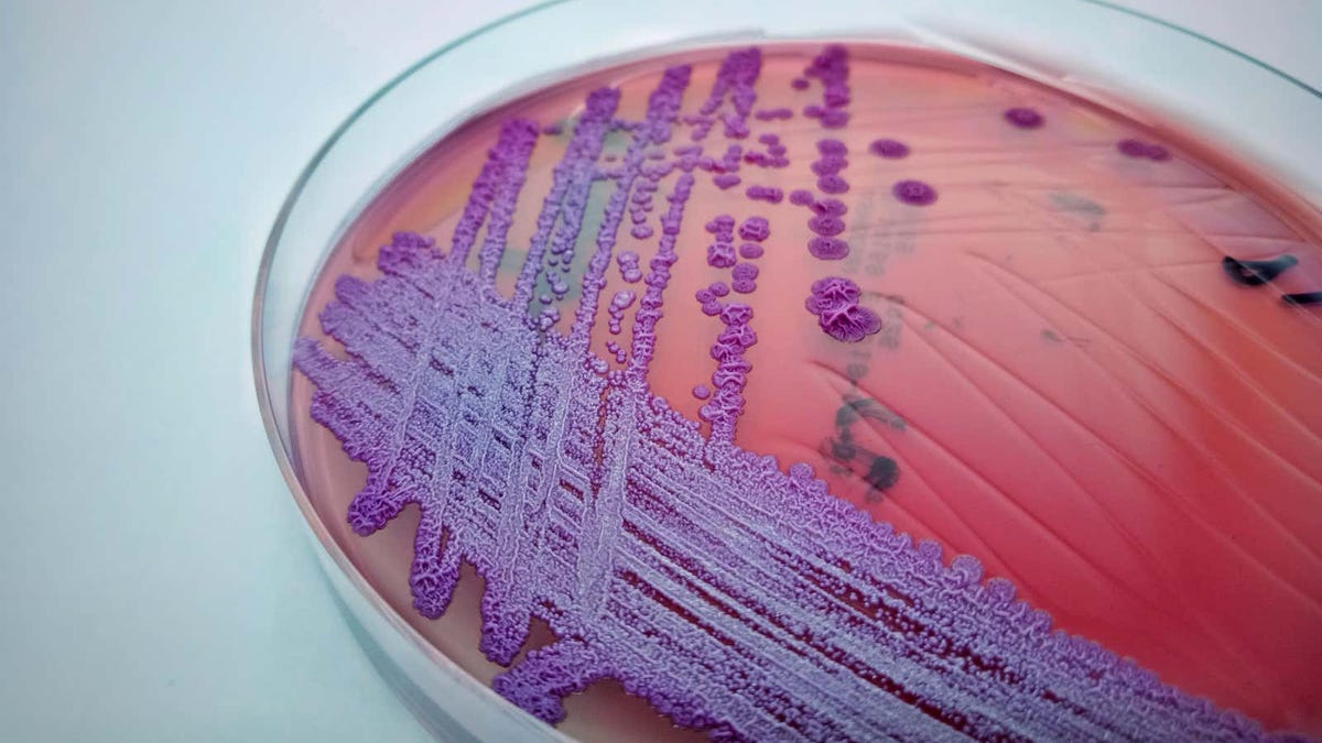 Encuentran bacterias tropicales mortales en EE. UU.