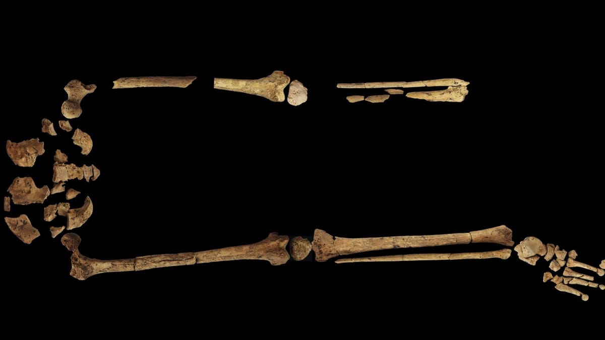 Este esqueleto prueba que hace 31000 años se amputaban miembros en medicina