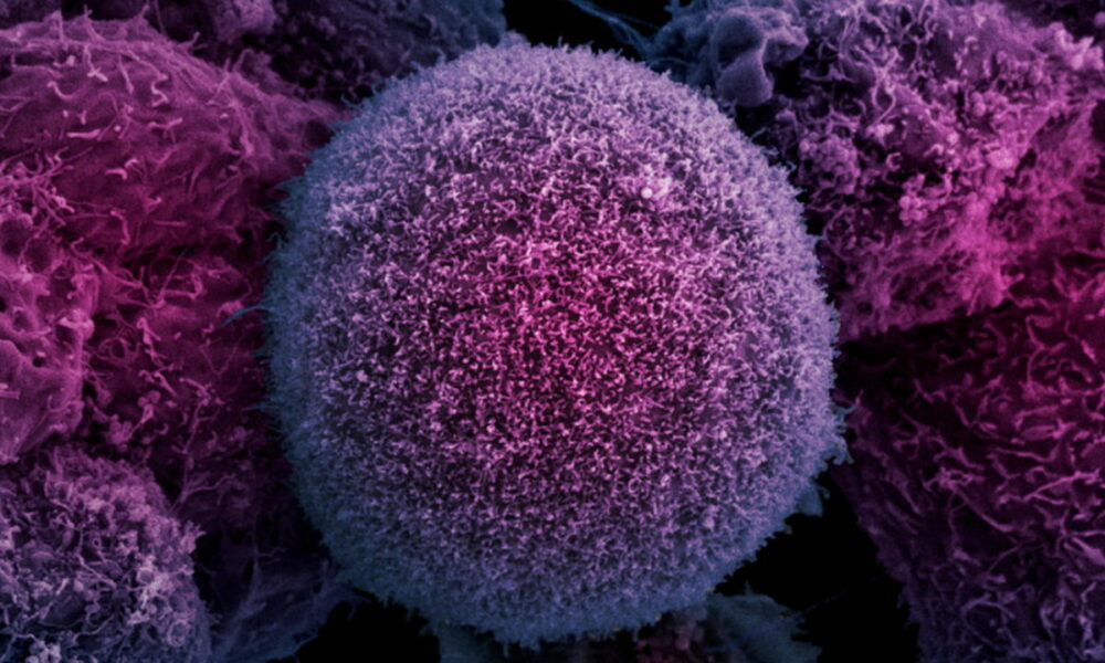 Destruir células cancerosas con máquinas moleculares vibrantes