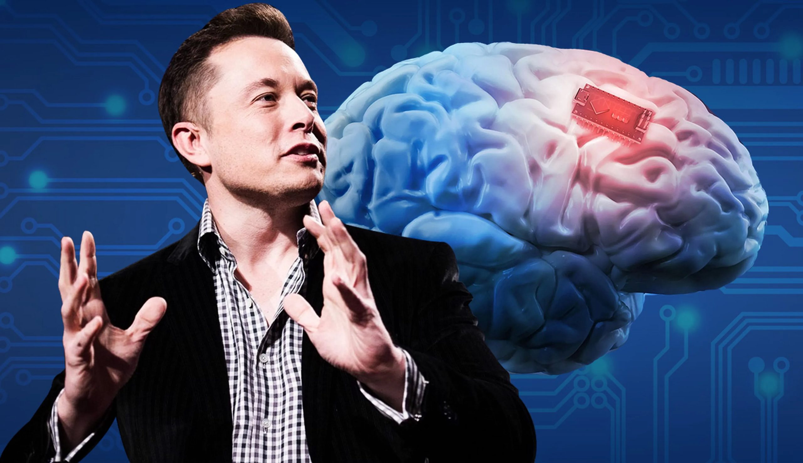 Elon Musk anuncia el primer paciente humano con implante Neuralink y afirma resultados prometedores