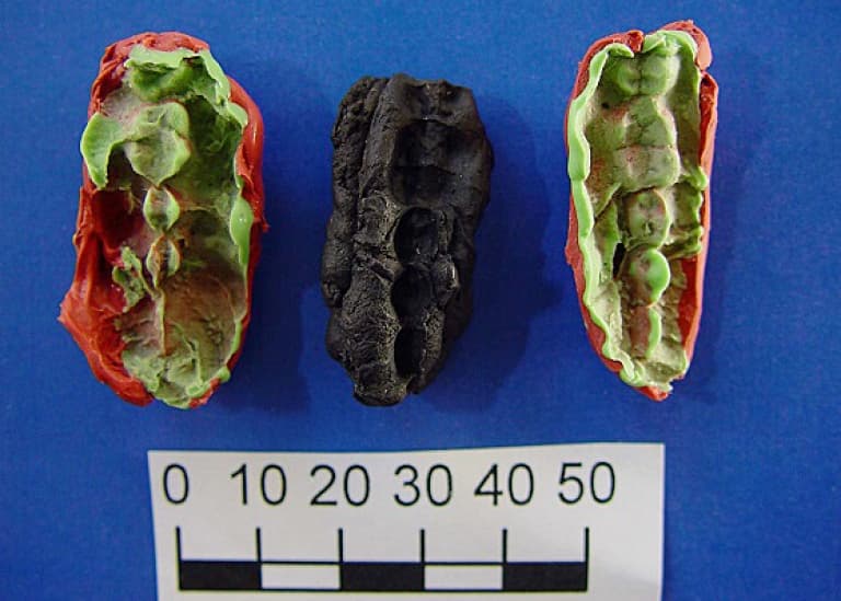 El chicle mesolítico revela una dieta antigua y problemas dentales