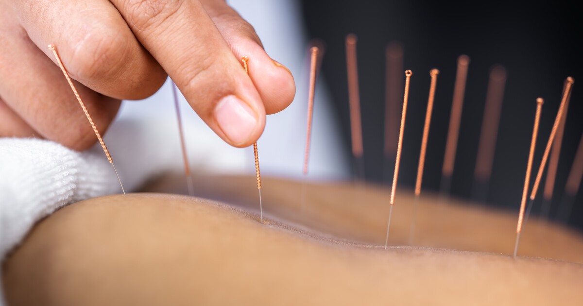 La acupuntura puede ayudar a los pacientes con accidente cerebrovascular a recuperar la voz