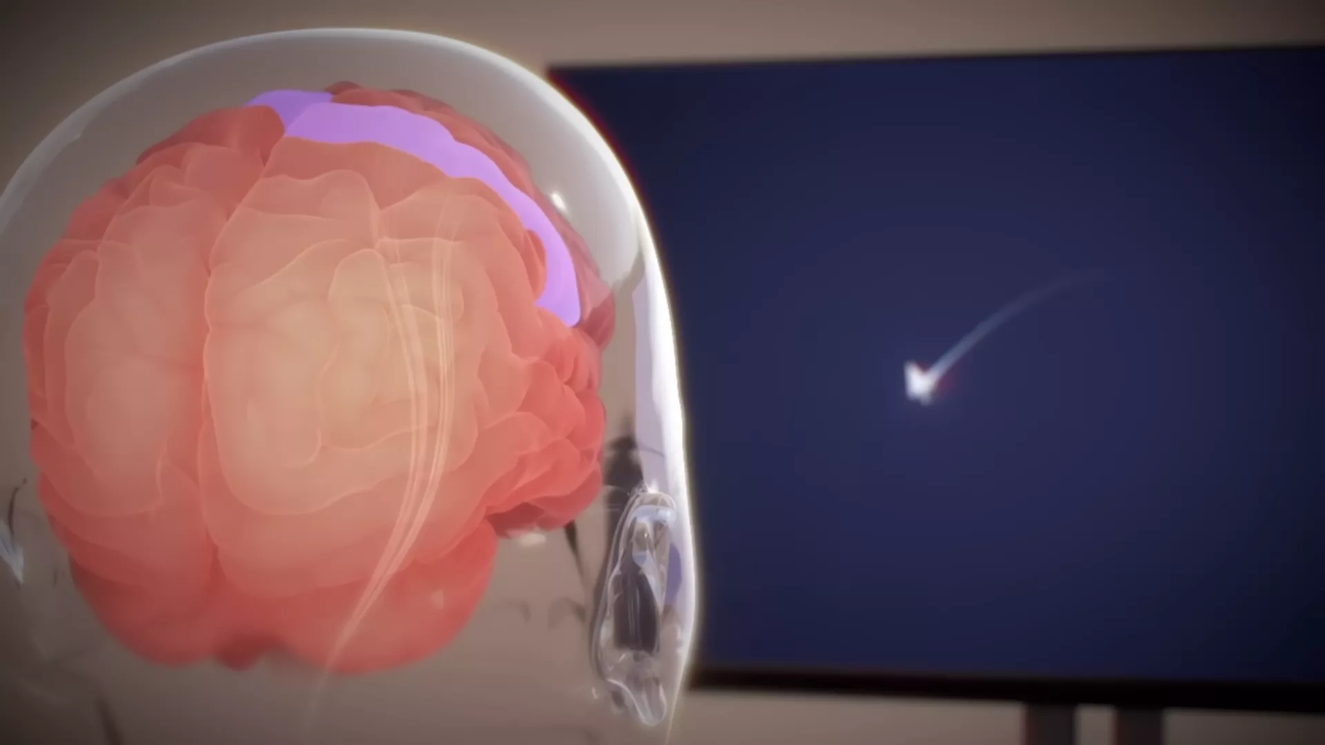 El primer sujeto humano de Neuralink controla con éxito el ratón de una computadora con pensamientos después del implante de un chip cerebral