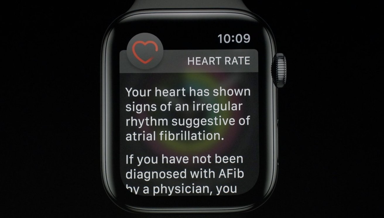 Apple Watch alerta al hombre sobre niveles peligrosos de estrés relacionado con el trabajo