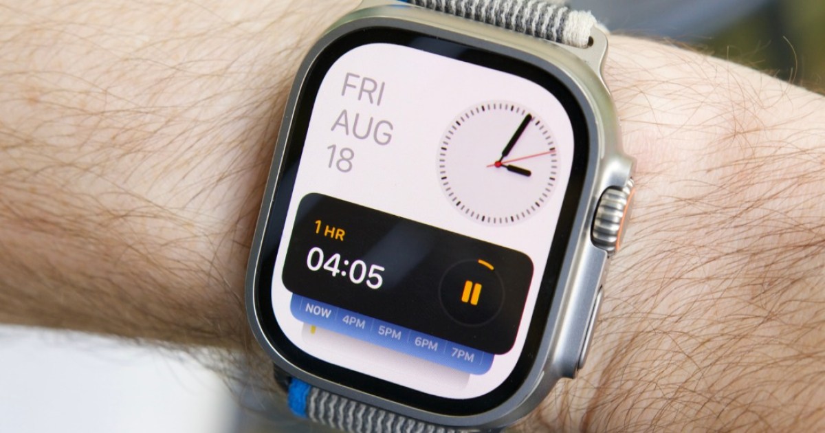 Apple Watch X: Las 9 cosas más importantes que quiero ver