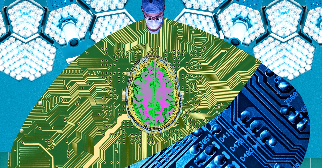 Su próximo trabajo: cirujano de interfaz cerebro-computadora