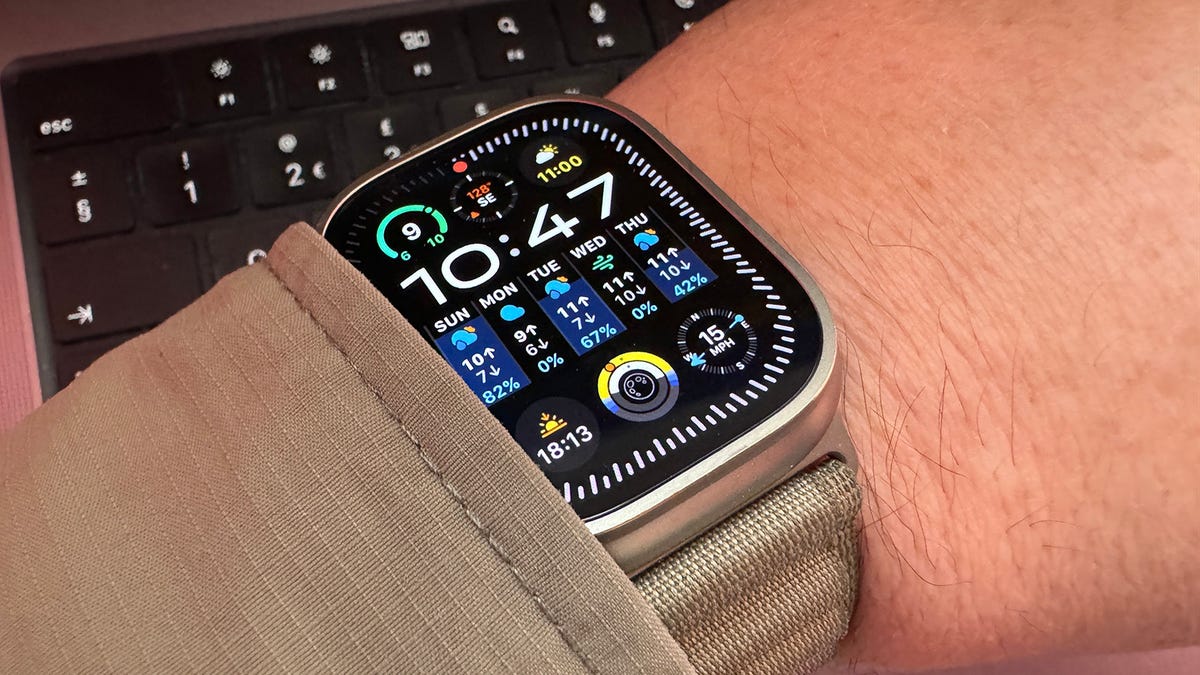 WatchOS 10.4 acaba con el molesto ‘toque fantasma’ del Apple Watch