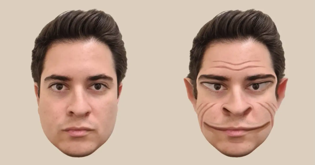 Nuevas imágenes muestran distorsiones faciales ‘demoníacas’ debido a una rara condición