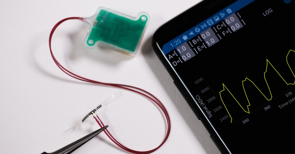 El sensor de vejiga envía alertas de «hora de orinar» a los teléfonos inteligentes de los pacientes