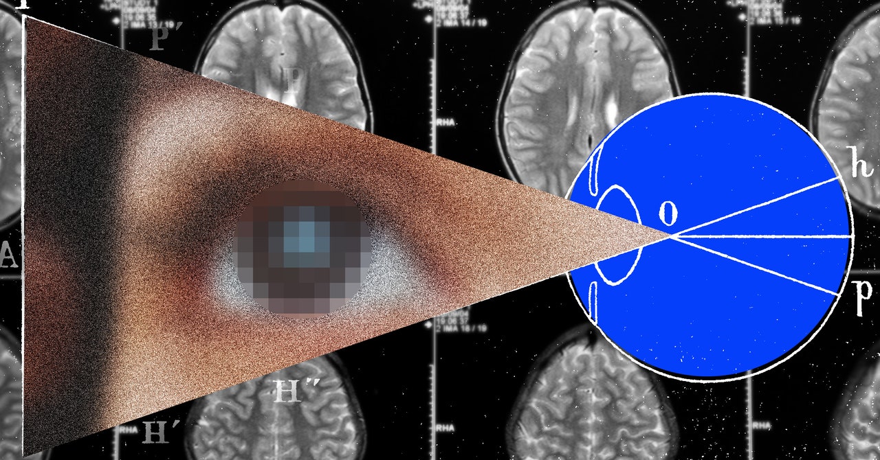 La próxima frontera para los implantes cerebrales es la visión artificial