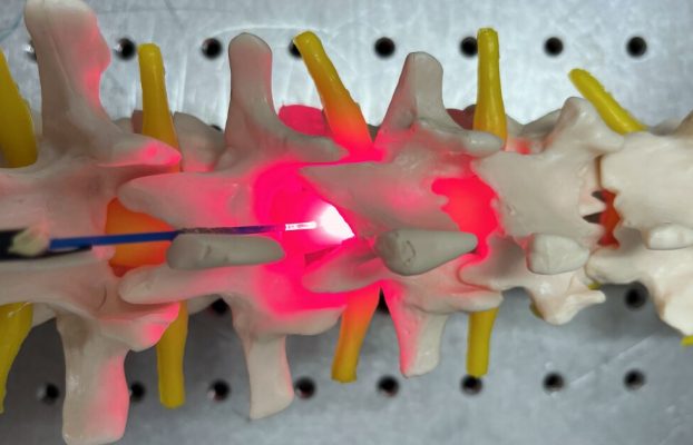 La terapia con luz roja espinal protege y regenera las células nerviosas dañadas