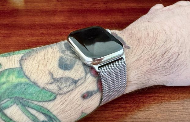 Problemas con el Apple Watch obligan a un usuario a eliminar un tatuaje