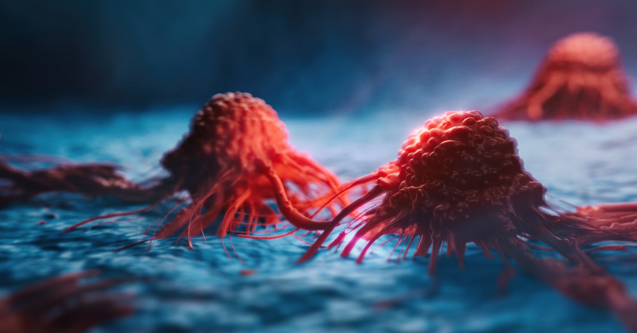 El cáncer de páncreas desactiva un gen clave para crecer