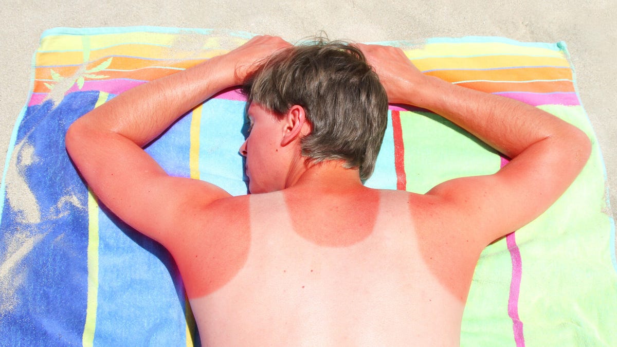 ¿Es posible revertir el daño solar en la piel? Preguntamos a los expertos