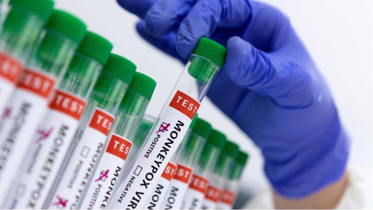 Confirmado el clado 2 del virus Mpox en un caso aislado en India, el Ministerio de Salud activa los protocolos de identificación