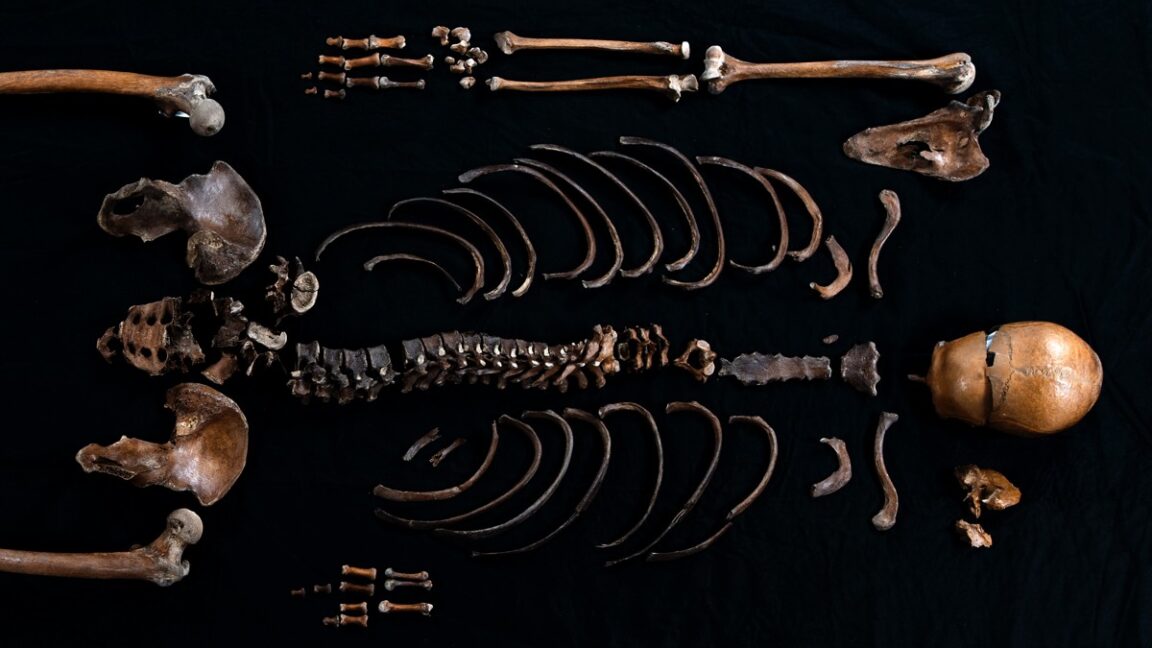 Estudio: el ADN corrobora la historia del «hombre sano» de la saga nórdica