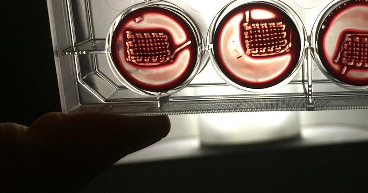 Implantes hechos con su sangre podrían reparar huesos rotos