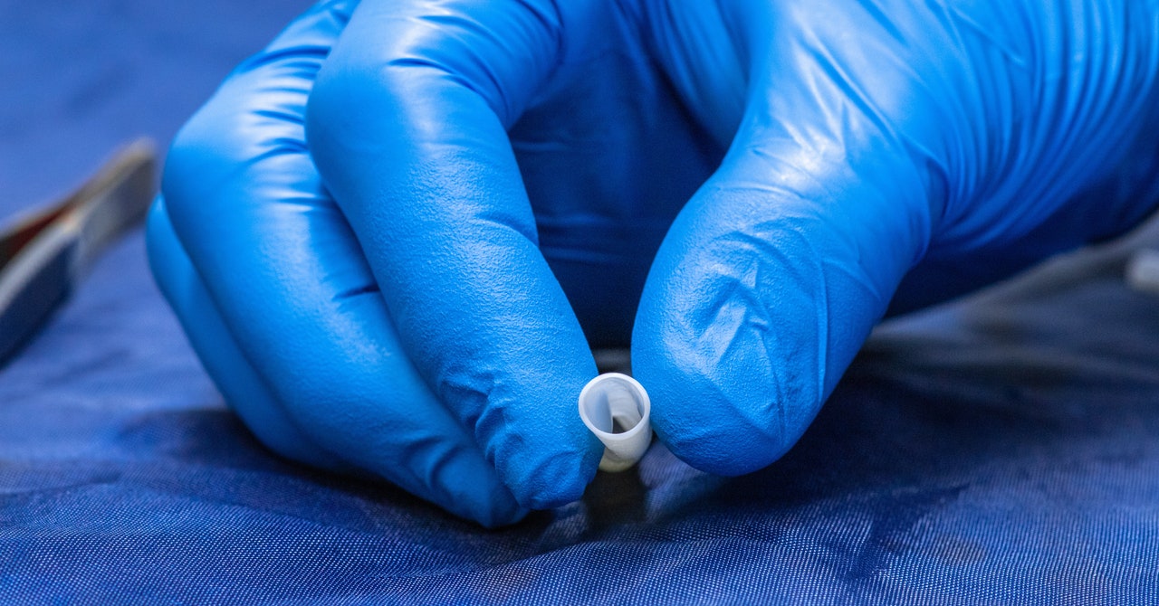 Este vaso sanguíneo se cultivó en un laboratorio con células humanas reales
