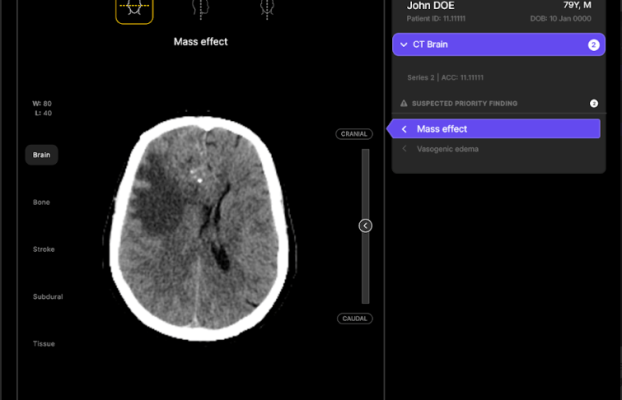 Startup de tecnología de salud australiana Harrison.ai obtiene $ 112 millones Serie C