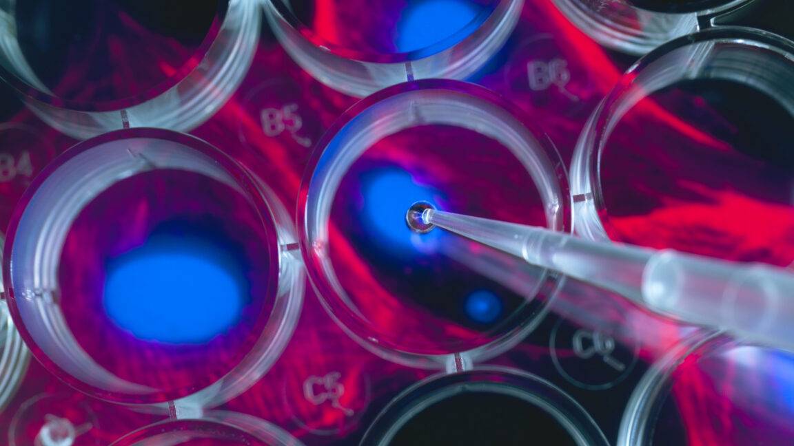 La nueva IA de Google genera hipótesis para los investigadores
