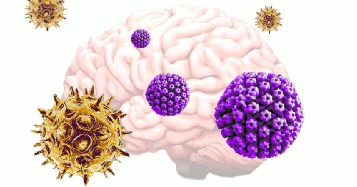 Un par de virus comunes pueden desencadenar la enfermedad de Alzheimer