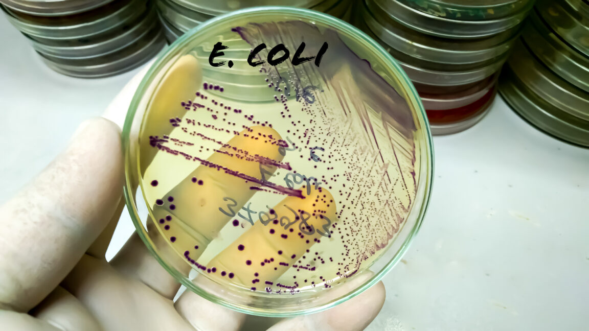 Los investigadores ingenieran bacterias para producir plásticos