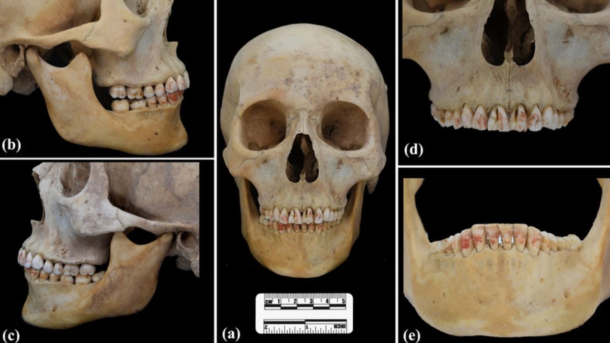 El entierro chino de 2.200 años descubre a las mujeres con dientes tóxicos manchados de rojo