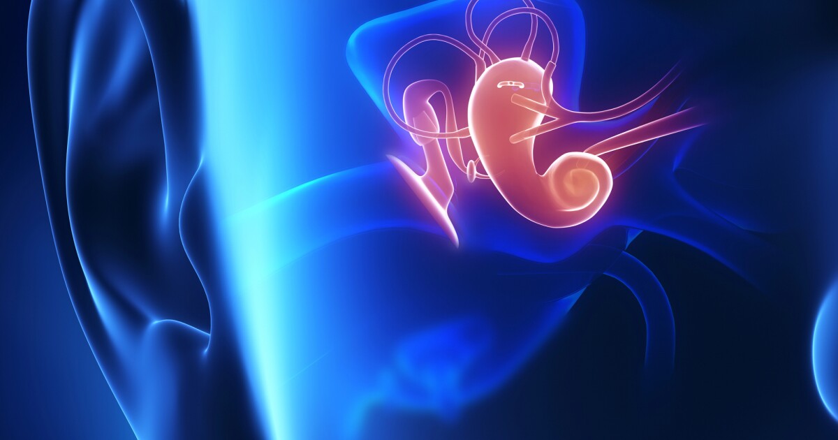 Nuevo tratamiento de tinnitus que bloquea los canales posteriores en el oído
