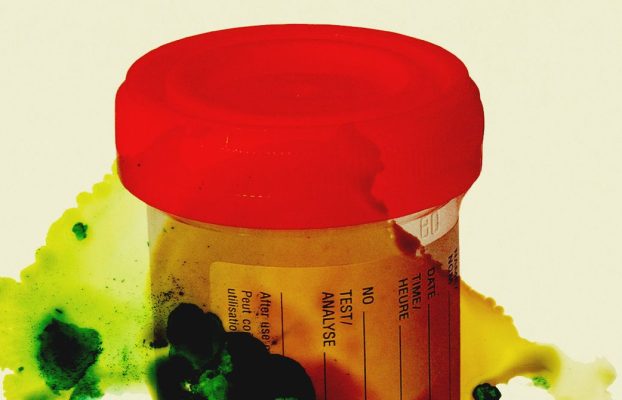 Miles de muestras de orina y tejido están en peligro de pudrirse después de que el personal corta en un laboratorio de los CDC