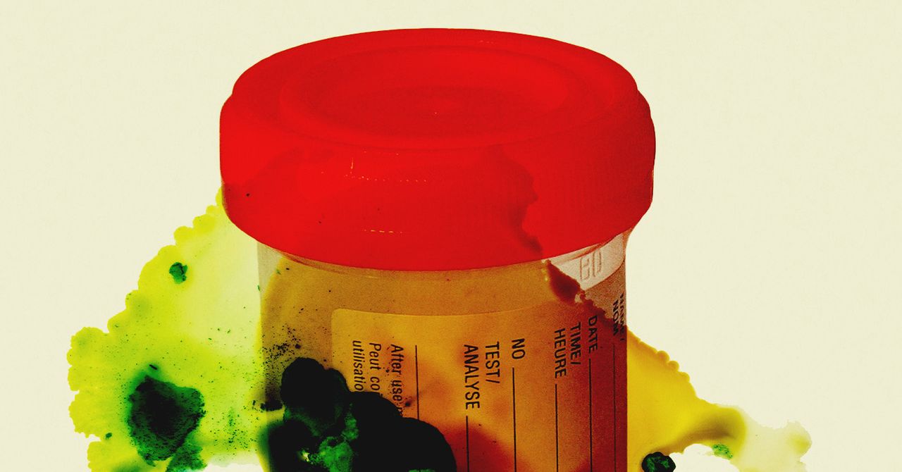 Miles de muestras de orina y tejido están en peligro de pudrirse después de que el personal corta en un laboratorio de los CDC