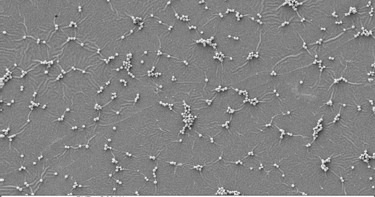 La nueva pintura antimicrobiana erradica las bacterias dañinas en el contacto