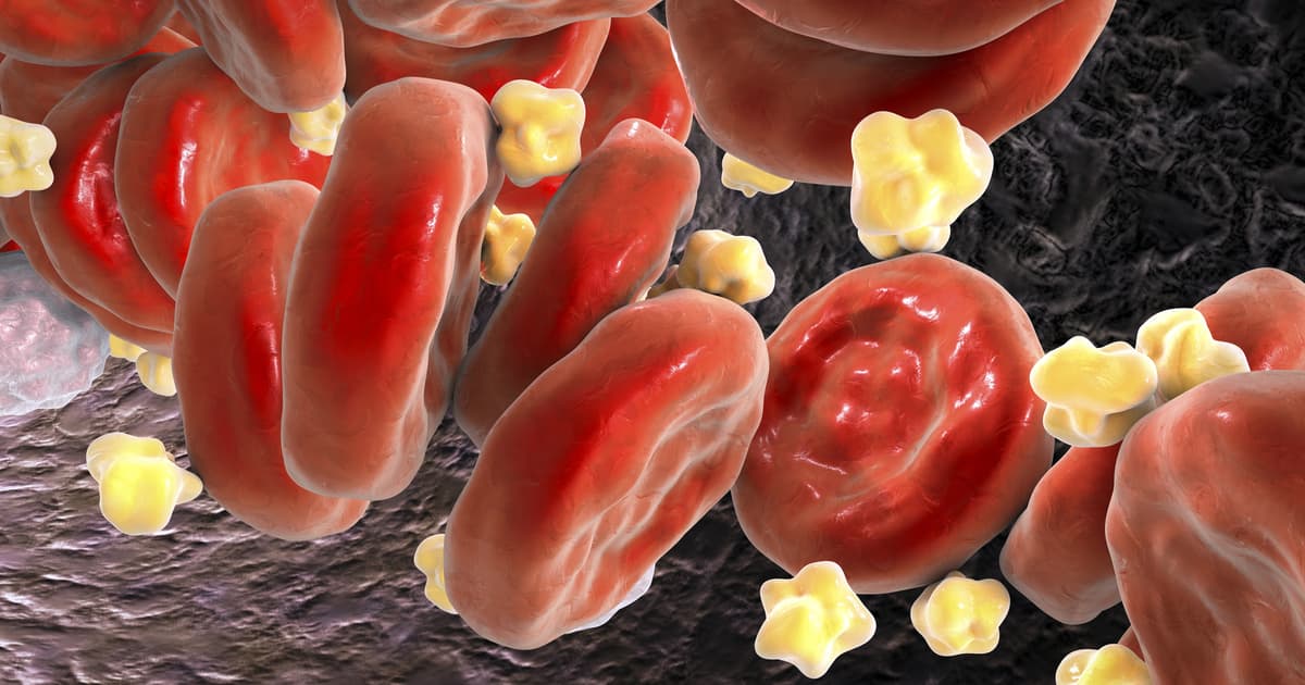 El nuevo combo de drogas corta el colesterol malo en casi la mitad en pacientes con alto riesgo