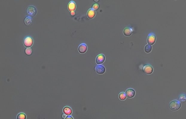 La levadura modificada convierte la orina en material óseo valioso