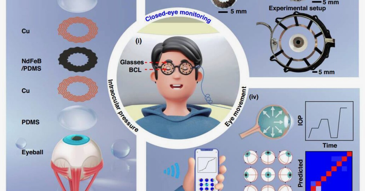 Nuevas lentes de contacto monitorear letreros de glaucoma durante el sueño